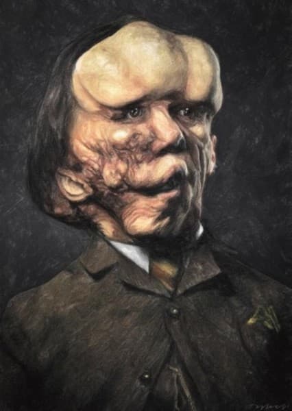 Joseph Merrick (The Elephant Man)