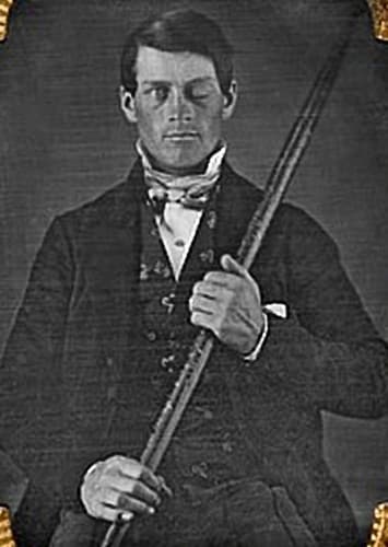 Phineas Gage