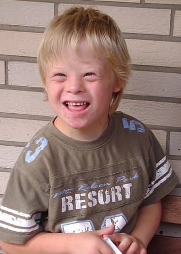 Down Syndrome